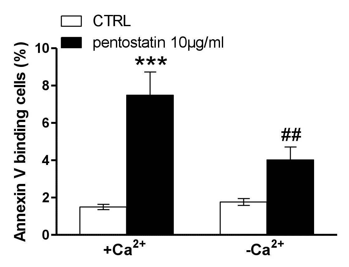 Fig. 4. Representative images and traces showing the accumulation and loss of NaFl in hypotonic 50% DMEM. The intensity was arbitrarily assigned the value of 1 at t=15 min of the accumulation phase (with extracellular NaFl, left) and t=45 s (when the first time point was recorded) of the release phase (in NaFl-free 50% DMEM, right). Scale bars in inserts, 25 µm. See text for more details.